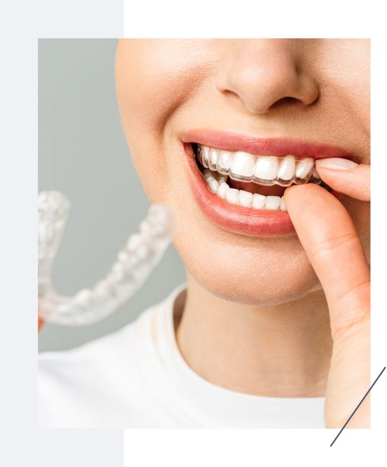 Women Smiling With Clear Braces In Grand Rapids, MI